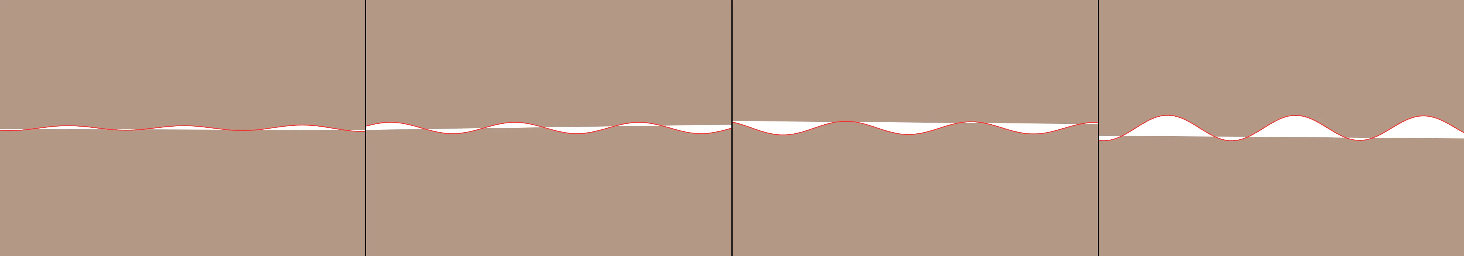 four frames from EKG patterns under a synthetic pointer